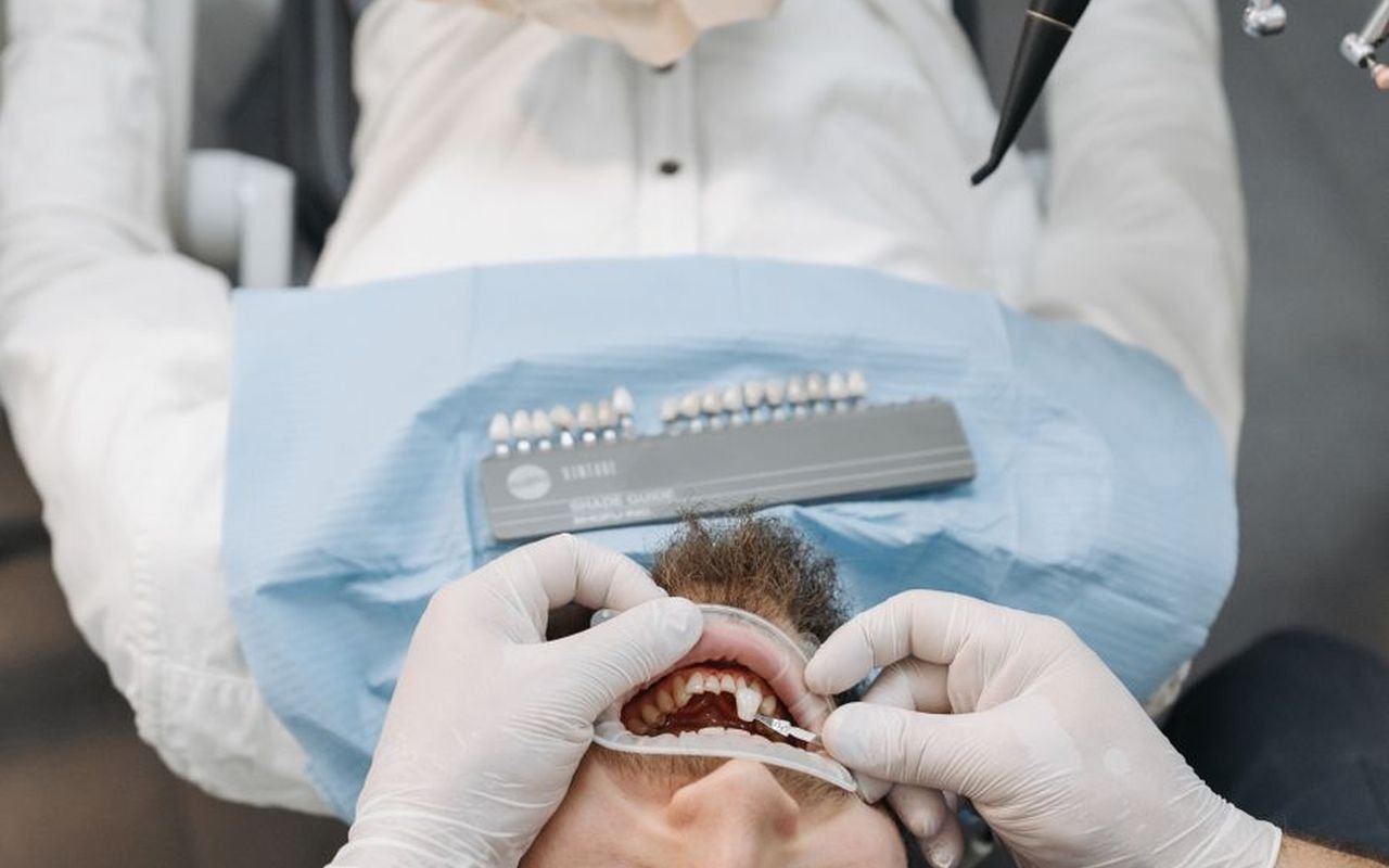 تجميل وتبييض الابتسامة
