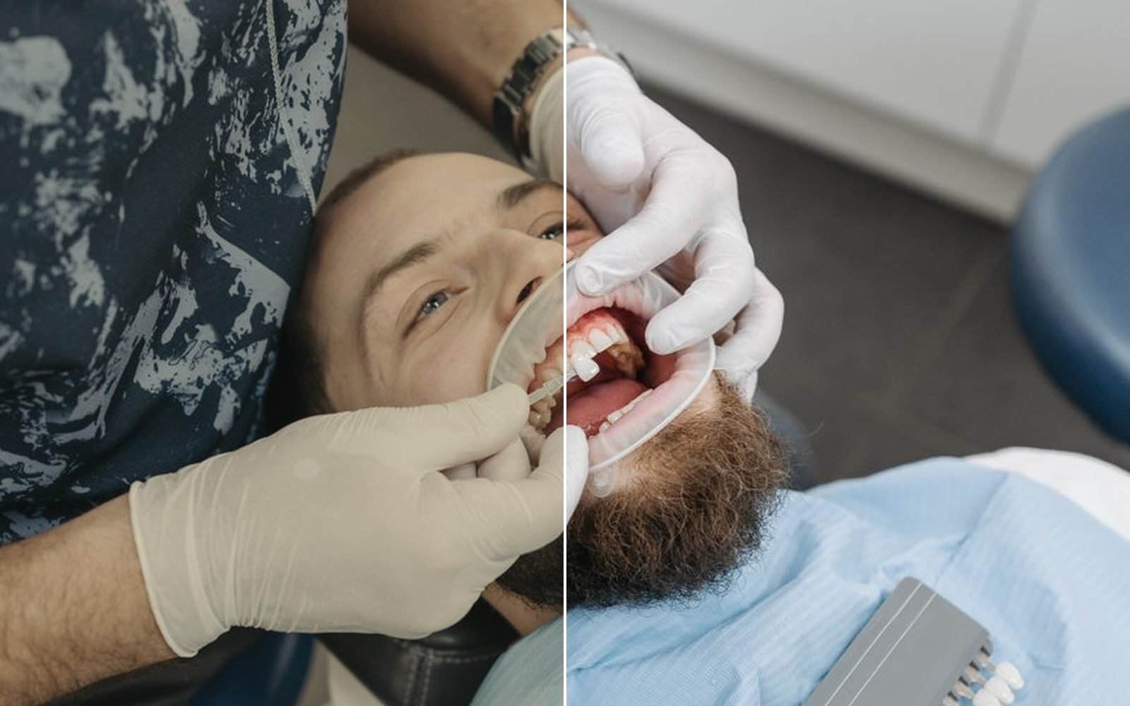 Clear aligners