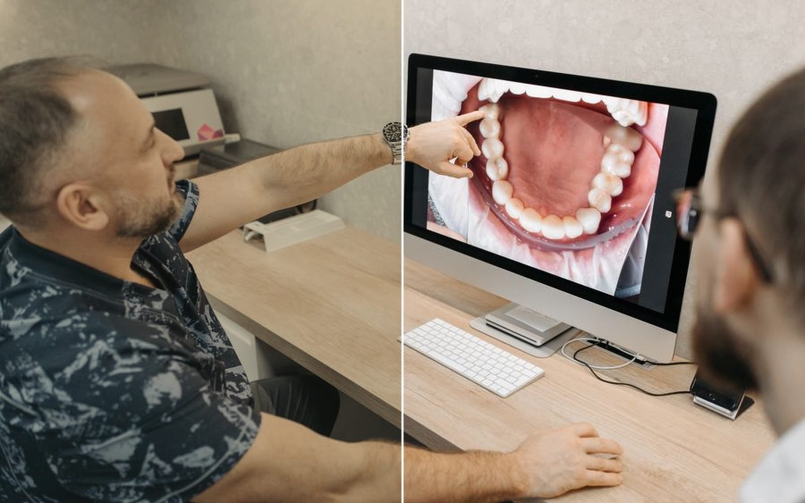Anterior implant