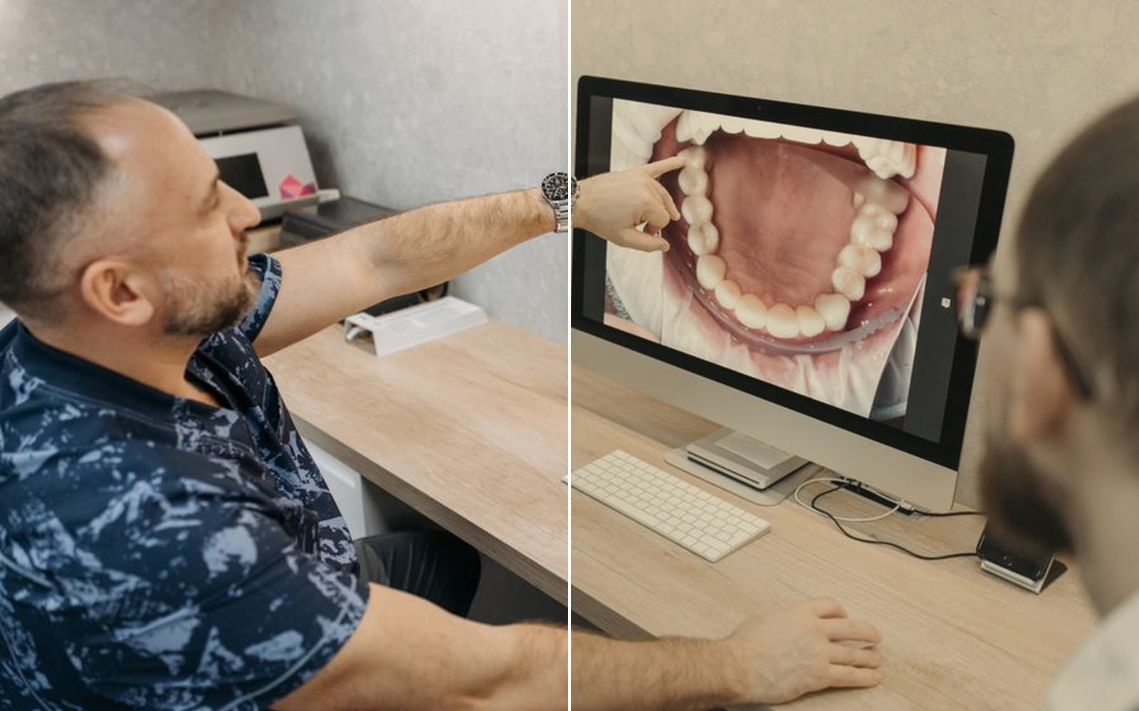 زراعة سنّ أمامي
