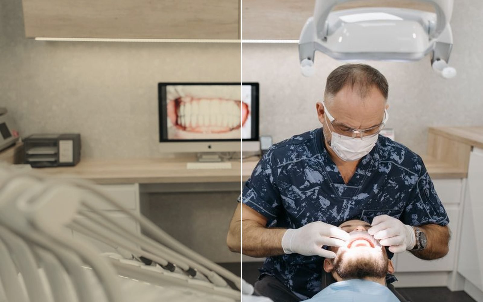 Full-mouth rehabilitation